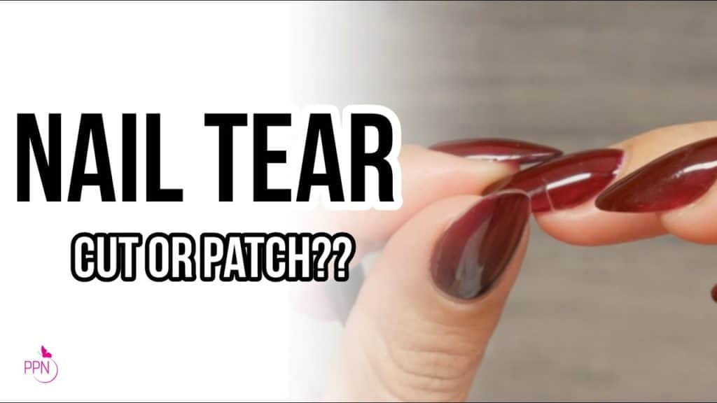 Should You Patch or Cut a Nail Tear?