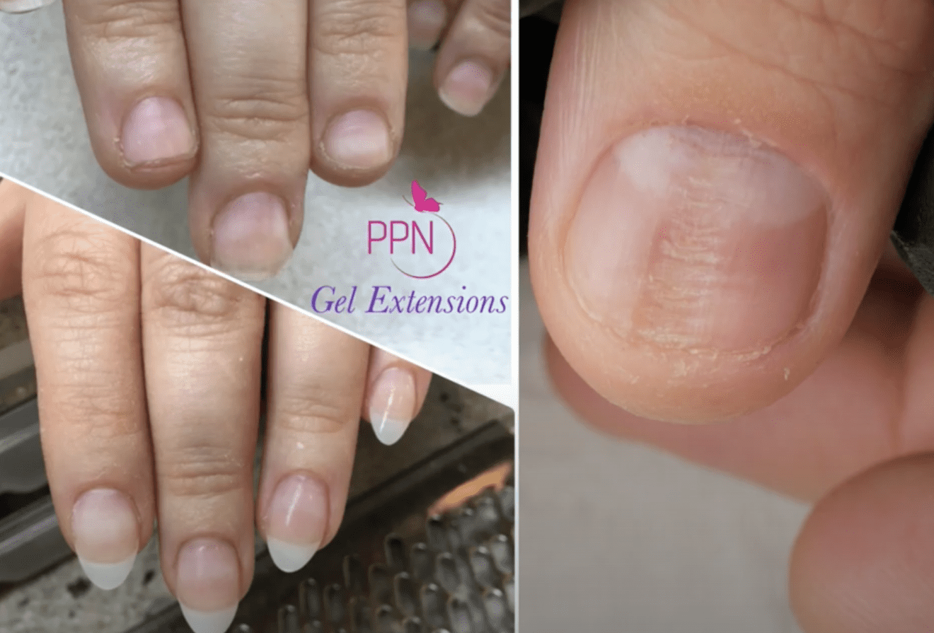 Extremely Bitten Nail To Long Transformation Using Japanese Gel Paola