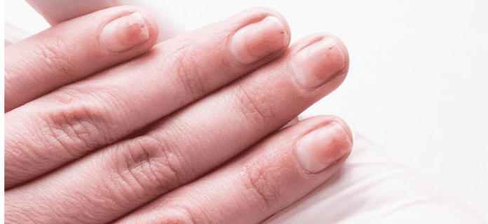 How to Remove Acrylic Nails at Home | POPSUGAR Beauty