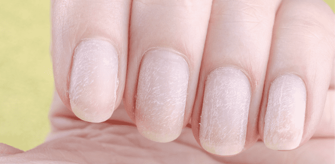 How to identify the cause of a nail break – Scratch