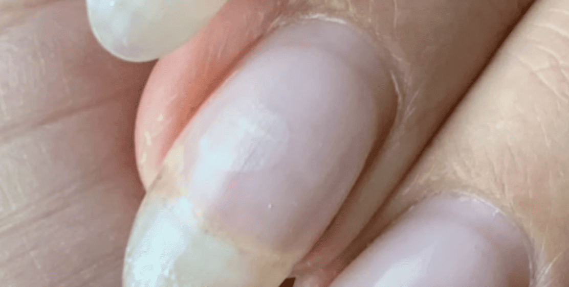 What Causes Pocket Lifting In Gel Nails And How To Prevent It Paola